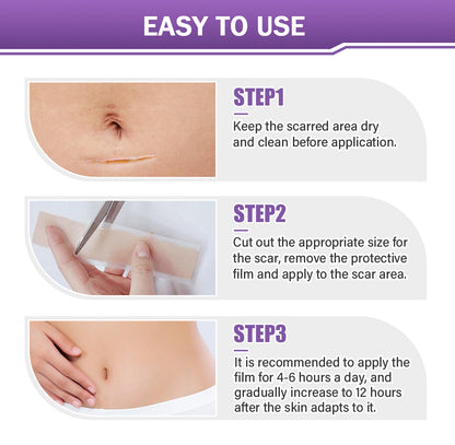 ✅Official Store |NEGUSY® Hyaluronic Acid Nano Microneedle Repair Tape🏉❤️
